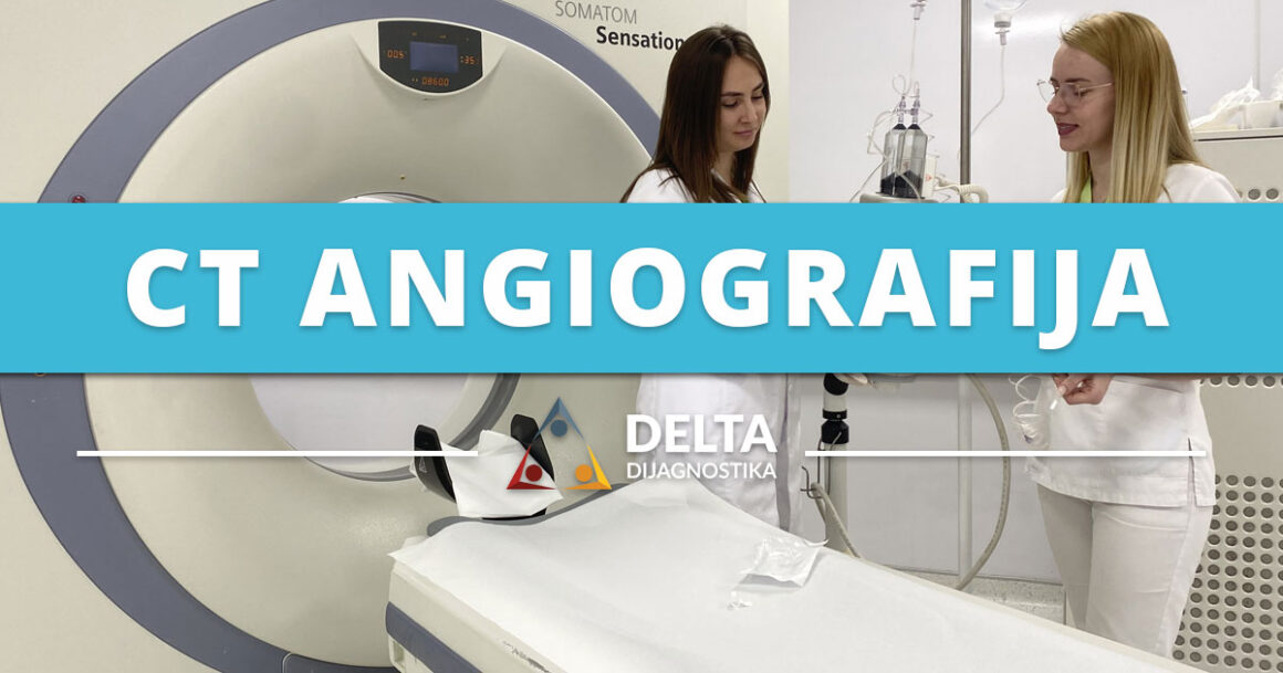 CT angiografija Banja Luka | CT snimanje i pregled
