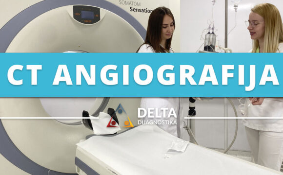 CT angiografija Banja Luka | CT snimanje i pregled