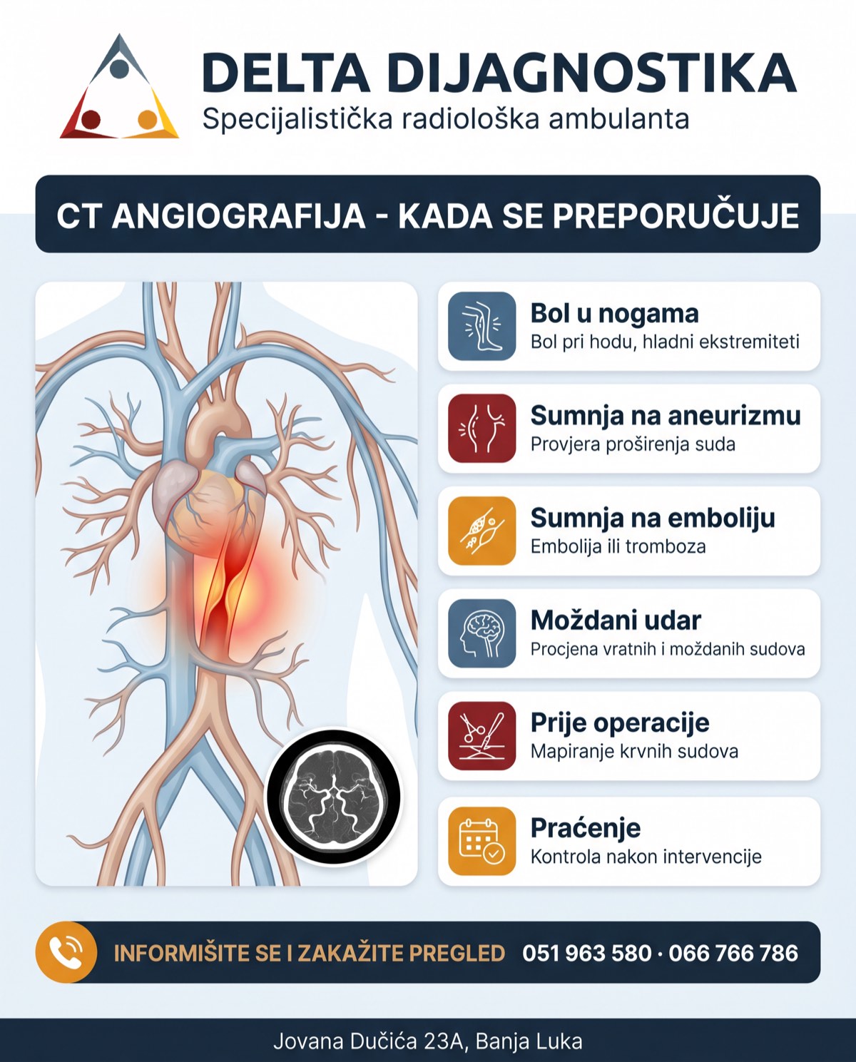 Kada se preporučuje CT angiografija - bol u nogama, aneurizma, embolija - Delta Dijagnostika Banja Luka